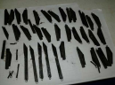 Doctors remove 40 knives from man’s stomach in India