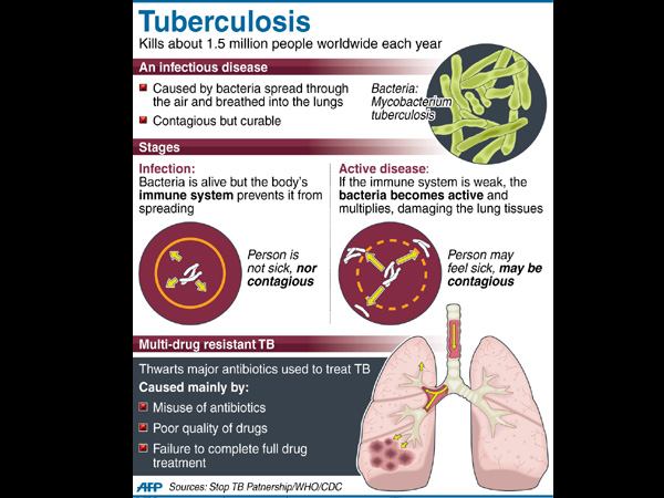 Third world is swamped with fake TB drugs, says study | Inquirer News