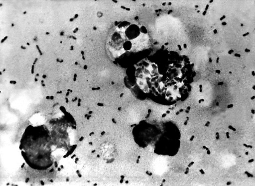 China diagnoses third case of bubonic plague