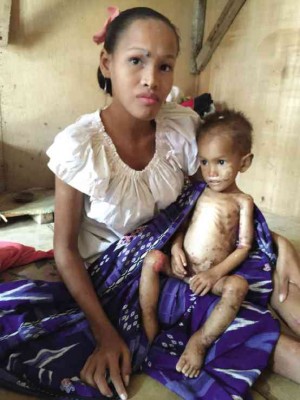 A Badjao woman with her severely malnourished child strike a pose reminiscent of the Madonna and Child at their unit in Masepla, a transition site for Zamboanga City residents displaced by war between government forces and followers of Moro leader Nur Misuari. JULIE S. ALIPALA/INQUIRER MINDANAO