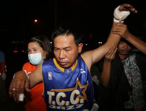 The Filipino man injured from firecrackers arrives at the East Avenue Medical Center in suburban Quezon city, north of Manila, Philippines Thursday, Jan. 1, 2015. Despite a ban by authorities on certain firecrackers due to injuries and death, many Filipinos still welcome the New Year with fireworks in the belief that it will drive away evil spirits and bring in good luck. (AP Photo/Aaron Favila)