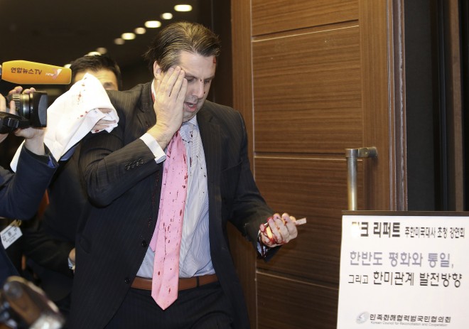 US Ambassador to South Korea Mark Lippert placing his right hand on his face leaves a lecture hall for a hospital in Seoul, South Korea, on March 5 after being attacked by a man. AP