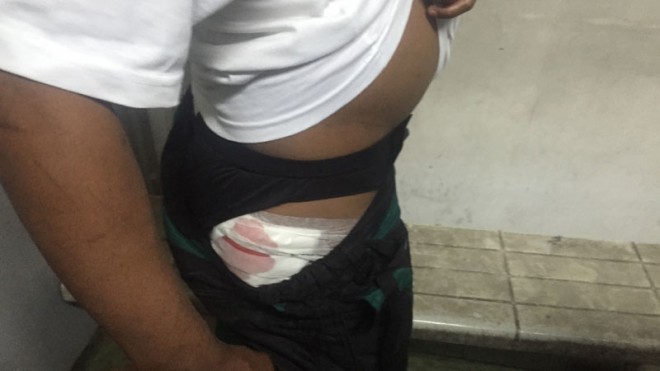 Junet Rufino shows the injury he sustained after being attacked by a wild carabao at the Mega-Q Mart in Cubao, Quezon City.