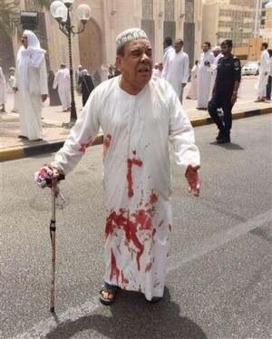 This image provided by Kuwaitna news shows a man in a blood-soaked dishdasha following of a deadly blast at a Shiite mosque in Kuwait City, Friday, June 26, 2015. A posting on a Twitter account known to belong to the Islamic State group claimed that the explosion was work of a suicide bomber wearing an explosive belt. (Kuwaitna News via AP)