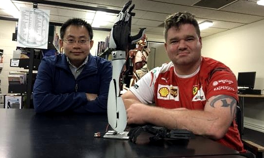 Dr Hong (L), also from Kuching, and Give A Hand founder David Drummond will give Ei Chi a mechanical hand as gift.