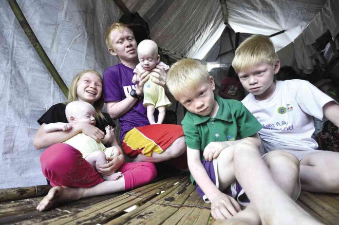 MEMBERS of a Manobo community with congenital albinism are among the thousands of “lumad” who fled their homes in Surigao del Sur province  and sought shelter in Tandag City. KING RODRIGUEZ/CONTRIBUTOR