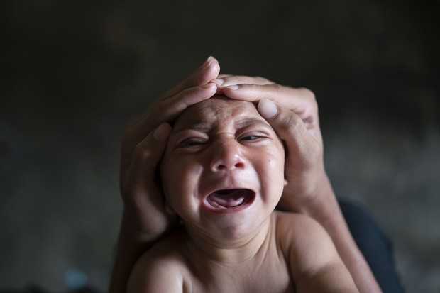 FILE - In this Jan. 30, 2016 file photo, Jose Wesley, who was born with microcephaly and screams uncontrollably for long stretches, is attended to in Bonito, Pernambuco state, Brazil. The Zika virus is drawing worldwide attention to a devastating birth defect that until now has gotten little public notice. Regardless of whether the mosquito-borne virus really causes babies to be born with abnormally small heads, a variety of other conditions can trigger it.  (AP Photo/Felipe Dana, File)