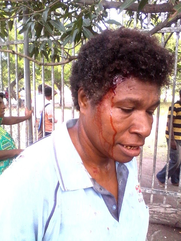 In this photo provided by Staycey Yalo,  34-year-old Esther Was bleeds from a head wound suffered during a student protest Wednesday, June 8, 2016, in Port Moresby, Papua New Guinea. Police fired gunshots to quell the protest demanding the resignation of Prime Minister Peter O'Neill, the government said. AP