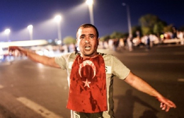 A man covered with blood stands near the Bosphorus bridge as Turkish military clash with people at the entrance to the bridge in Istanbul on July 16, 2016.  Turkish military forces on July 16 opened fire on crowds gathered in Istanbul following a coup attempt, causing casualties, an AFP photographer said. The soldiers opened fire on grounds around the first bridge across the Bosphorus dividing Europe and Asia, said the photographer, who saw wounded people being taken to ambulances. AFP