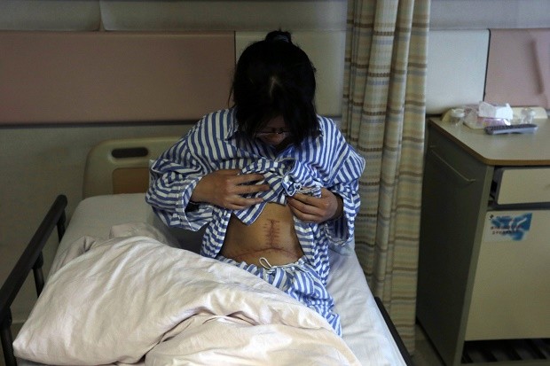 China Organ Transplants
