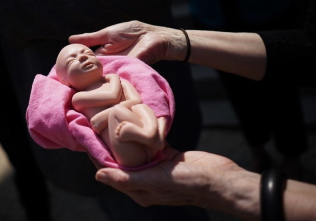 An anti-abortion activist holds a model of a fetus during a protest outside of the Longworth House Office Building on Capitol Hill in Washington, DC on May 7, 2015. Protesters are demanding Republican lawmakers approve a bill banning all abotions after 20 weeks. AFP PHOTO/MANDEL NGAN / AFP PHOTO / MANDEL NGAN