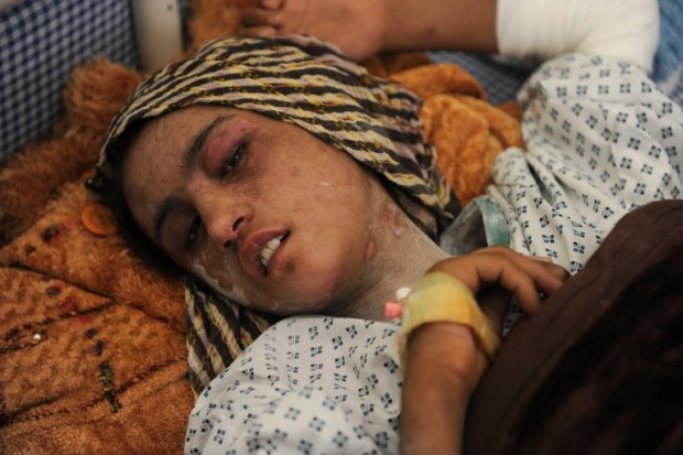 Afghan child bride Sahar Gul, 15, lies in a bed as she recovers at the Wazir Akbar Khan hospital in Kabul on January 12, 2012. Afghan President Hamid Karzai pledged January 12 to take action against the "cowardly" perpetrators of violence against women in the wake of a horrific case of the torture of a child bride. The president made the commitment after a visit by a delegation from the Afghan Women's Network over Sahar Gul, 15, who was burned and beaten and had her fingernails pulled out after she defied efforts to force her into prostitution. Gul was found last month in the basement of her husband's house in northeastern Baghlan province, where she had been locked in a toilet for six months by her husband and his parents.  AFP PHOTO/ SHAH Marai / AFP PHOTO / SHAH MARAI