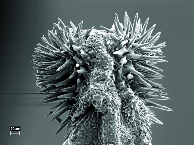 SPIKED A seed beetle’s penis resembling amedieval, spike-studded steel ball as seen through a microscope. —AFP