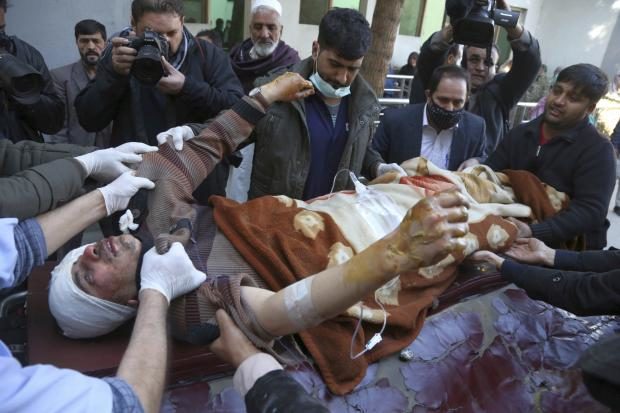 Injured man in Kabul bombing - 28 Dec 2017