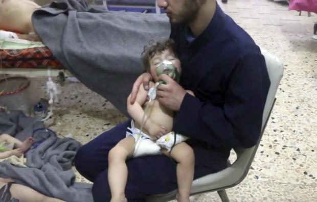 Syrian toddler being given oxygen