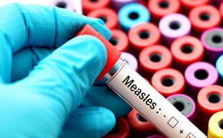 Failure of health system leads to measles outbreak – UNICEF