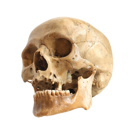 skull, head
