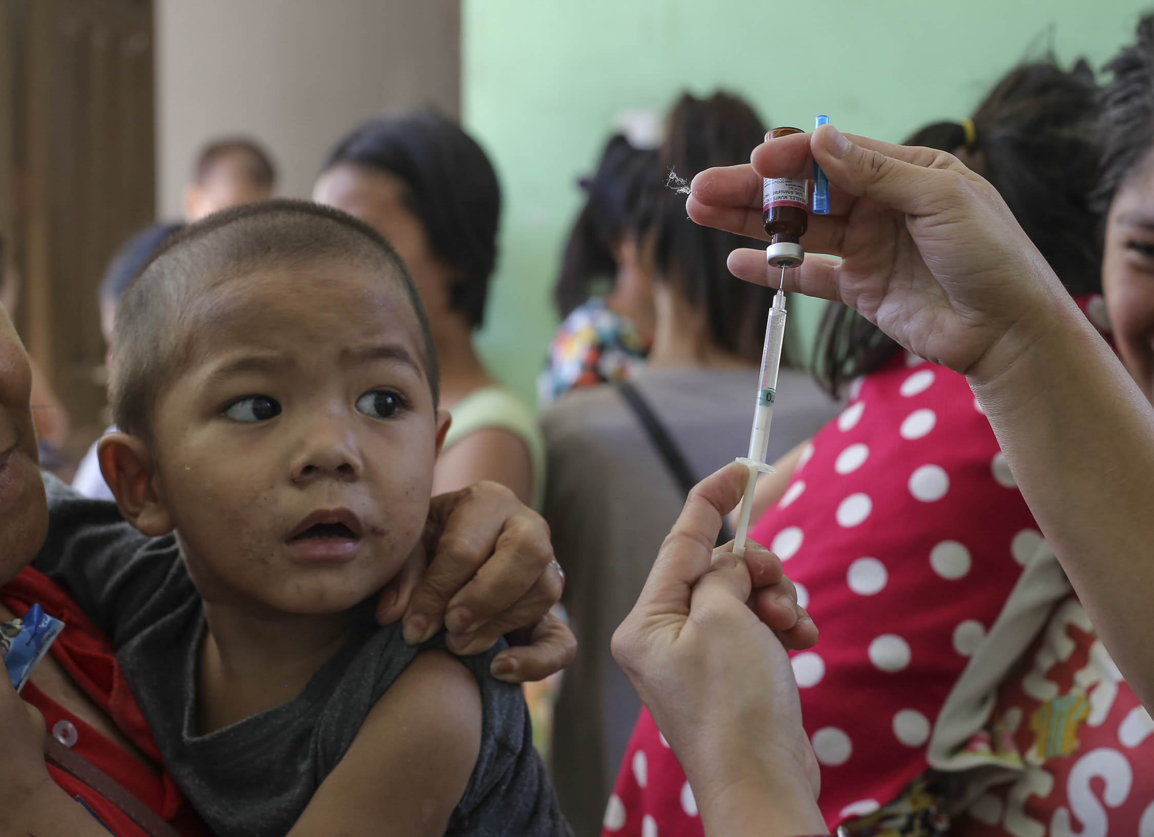 DOH expects measles surge in Calabarzon