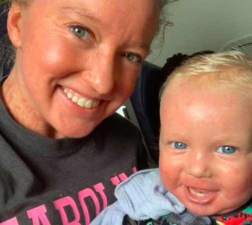 Airline apologizes for kicking out mom, baby with rare skin condition
