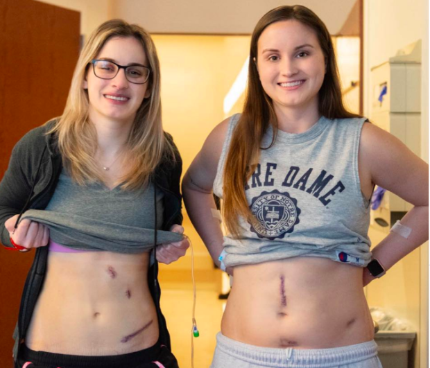 2 sisters donate kidneys after losing dad to kidney failure