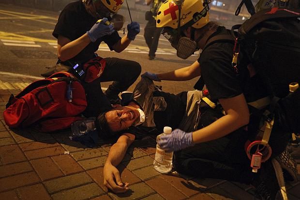  Injured protester in Hong Kong