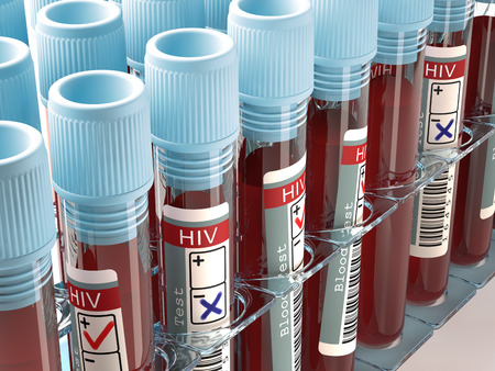 New 'highly virulent' HIV strain discovered in the Netherlands