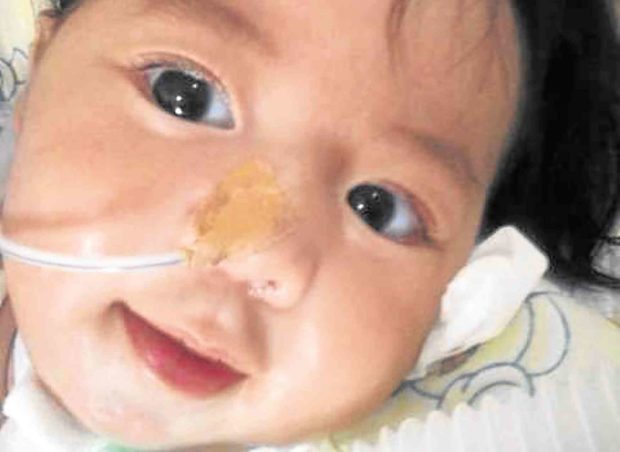 7-month-old baby diagnosed with rare disease | Inquirer News