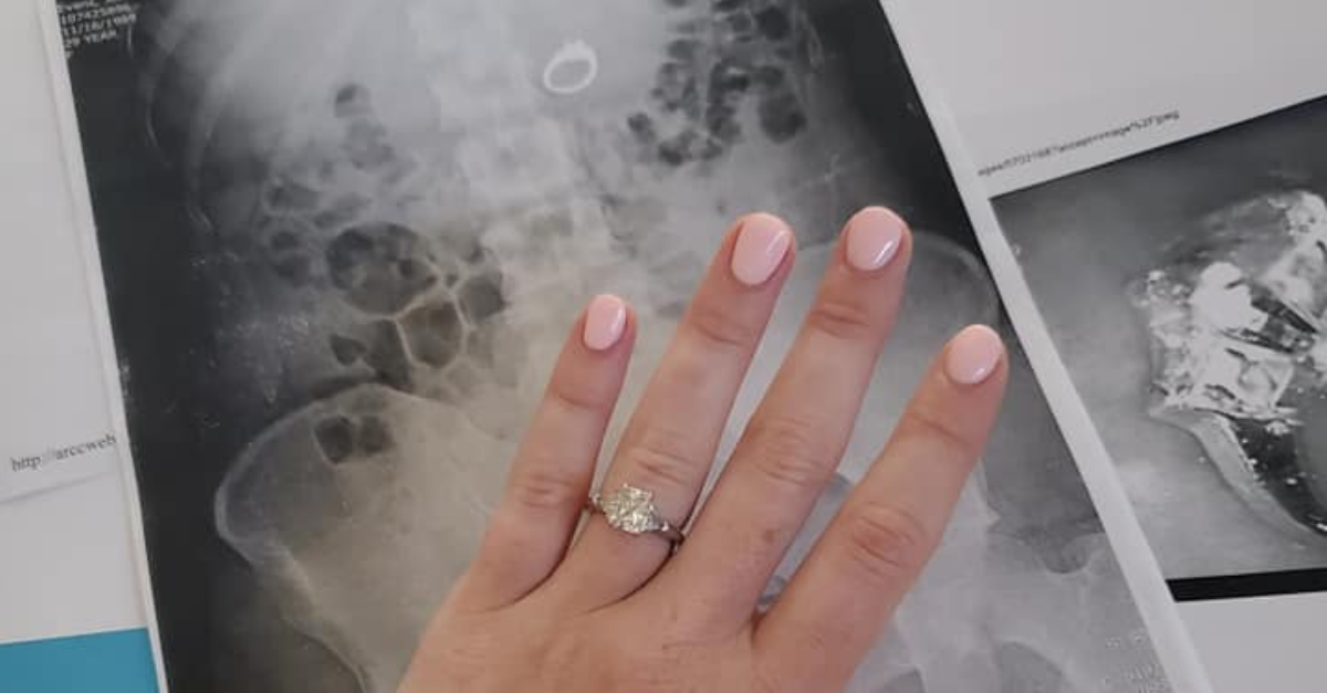 Woman swallows engagement ring ‘to protect it’ Inquirer News