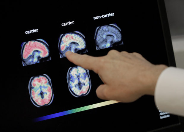  Biogen reanalyzes studies, presses ahead on Alzheimer's drug
