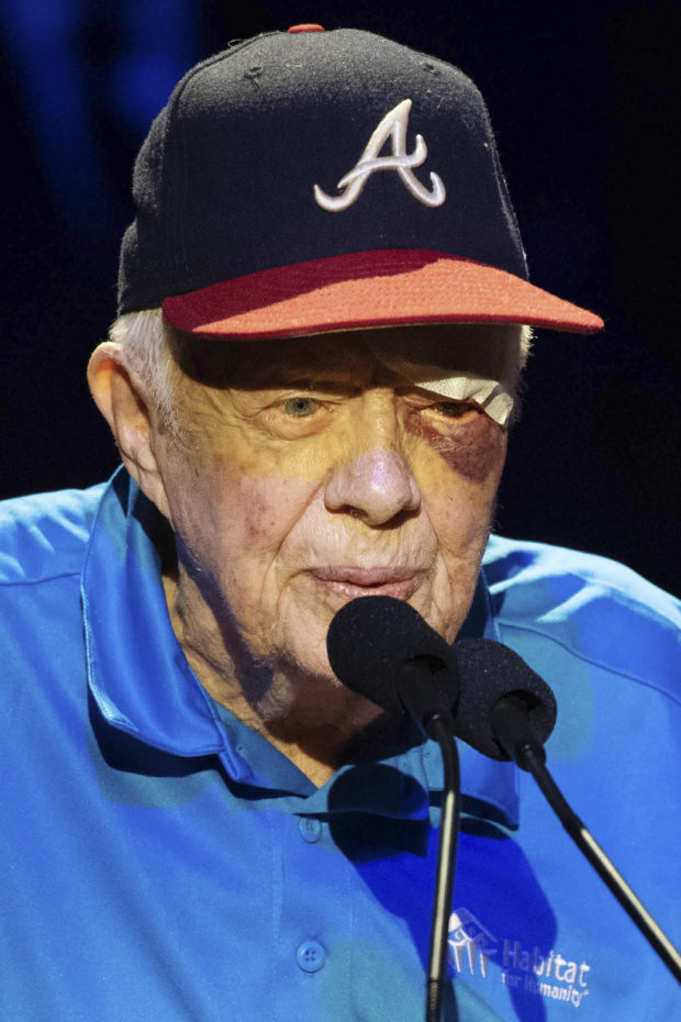 Ex-President Jimmy Carter has black eye, stitches after fall