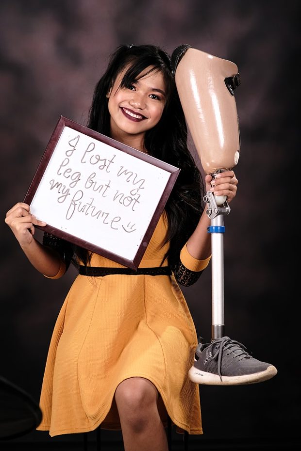LOOK: Isabela student proudly holds prosthetic leg in creative graduation photo
