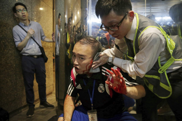  Attacker bites politician's ear, others slashed in Hong Kong