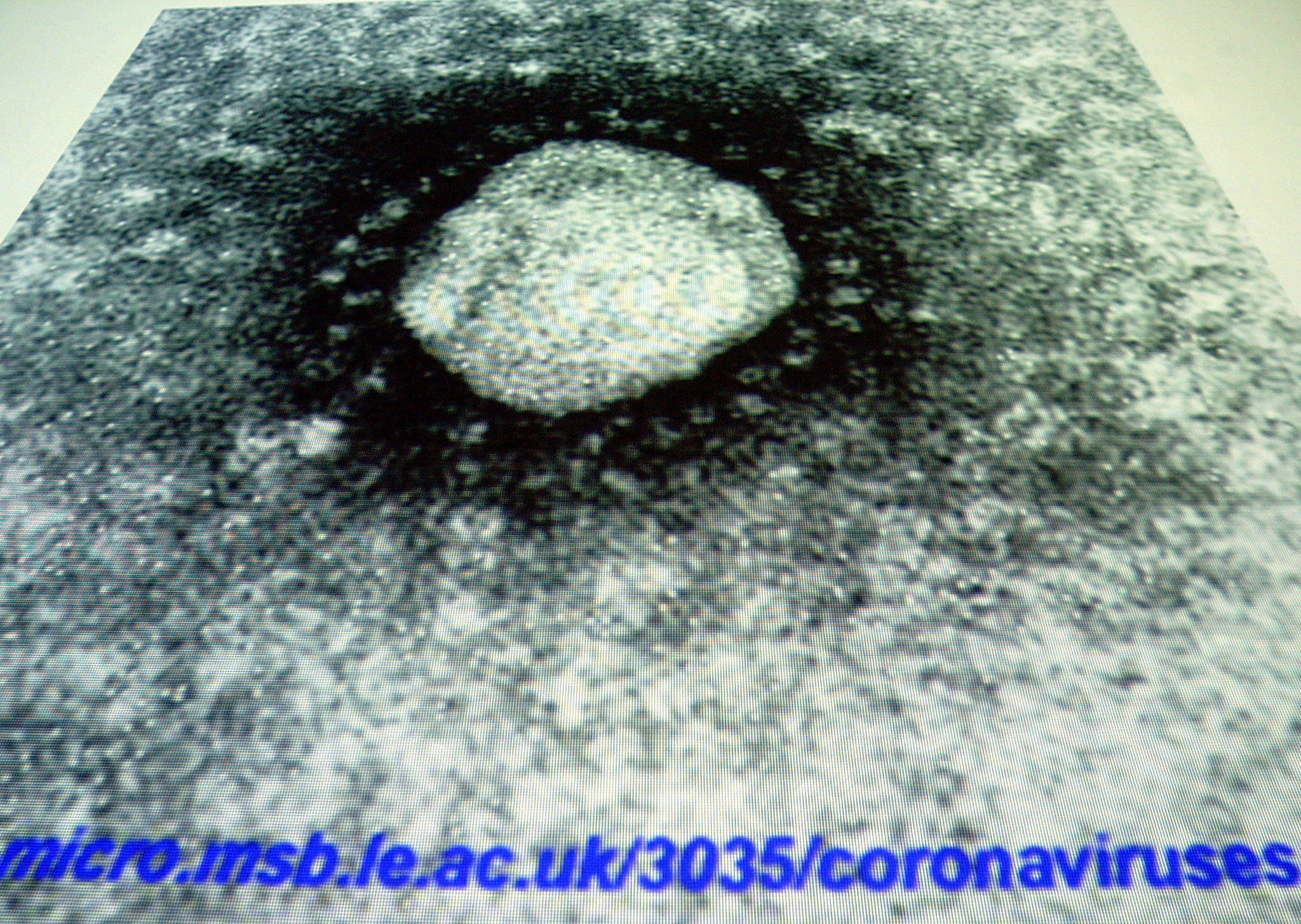 Коронавирус обычный. Коронавирус фото. Реальное изображение коронавируса.