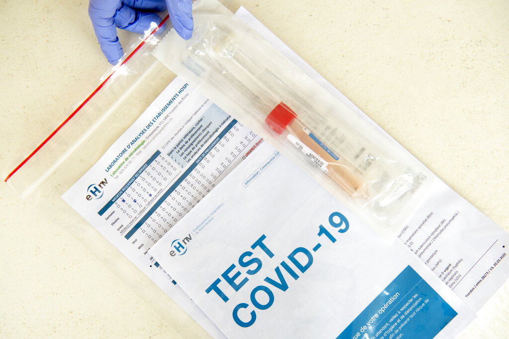 covid-19 test kit  coronavirus