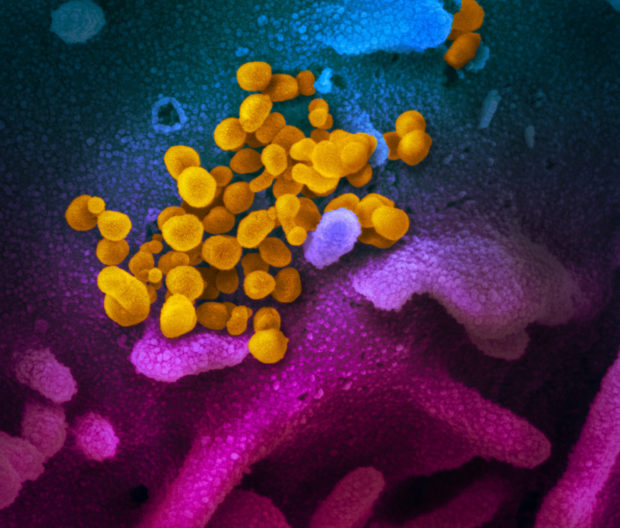 electron microscope image, coronavirus, SARS-CoV-2