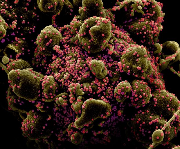 File photo of a colorized scanning electron micrograph of an apoptotic cell and on Tuesday, vaccine manufacturers were urged to start applying for a certificate of product registration. 
