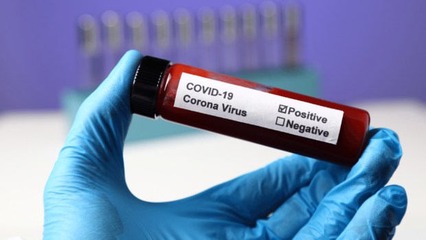 The photo shows a test tube indicating positive test for COVID-19 which active cases in the Philippines hit 14,862