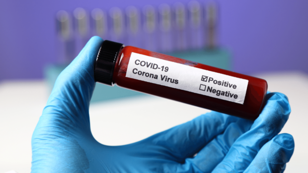 PH reports 433 new COVID-19 infections on Christmas Day