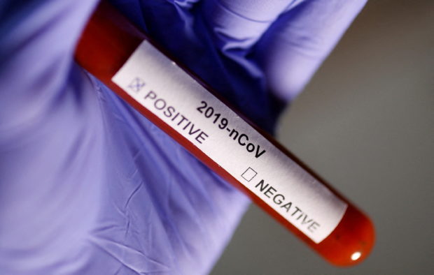 Test tube with Coronavirus label is seen in this illustration taken on January 29, 2020. REUTERS/Dado Ruvic