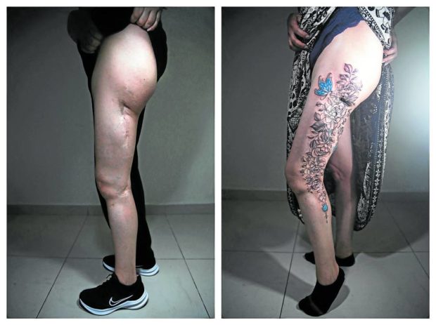 Tattoos help women go from hurt to healed