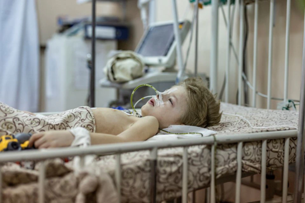 Dima, a three-year-old boy who was wounded during the shelling of Mariupol