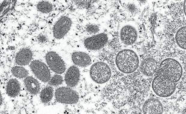 An electron microscopic image shows mature, oval-shaped monkeypox virus