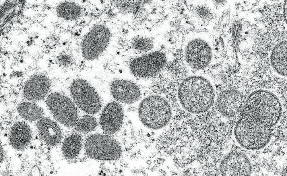  An electron microscopic image shows mature, oval-shaped monkeypox virus