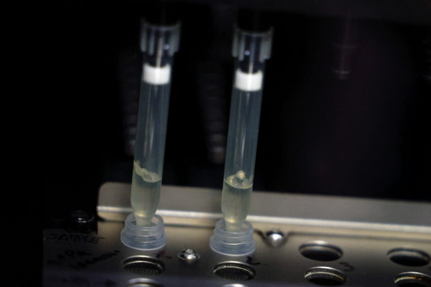 FILE PHOTO: Two samples of suspected cases of monkeypox go through a process of nucleic acid extraction as they get tested at a microbiology lab at La Paz Hospital in Madrid, Spain, June 1, 2022. REUTERS/Susana Vera