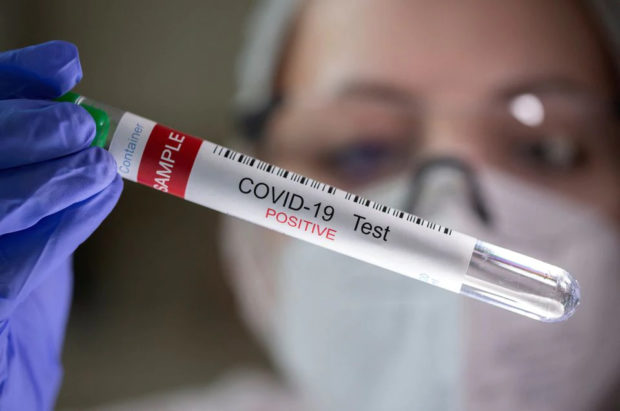 Nearly 1 in 5 adults who had COVID-19 have lingering symptoms—US study
