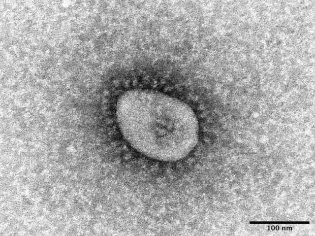 Courtesy of the National Institute of Infectious Diseases An electron micrograph of the omicron coronavirus variant