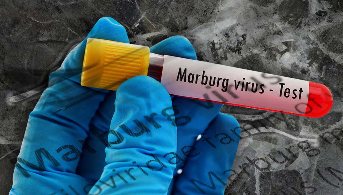 Marburg: What to know about the latest killer virus without a cure yet