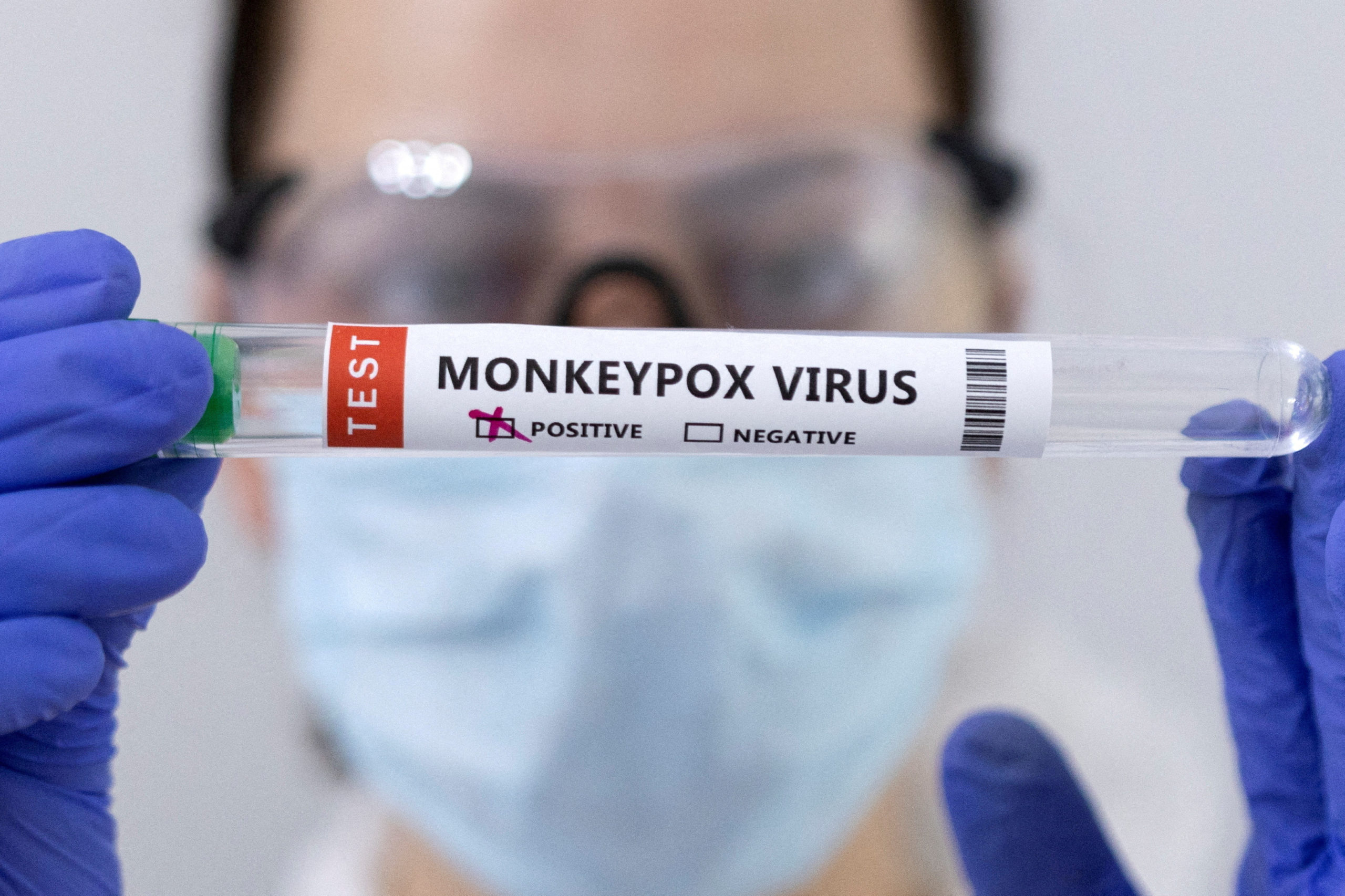 Negros Occidental monkeypox test kits