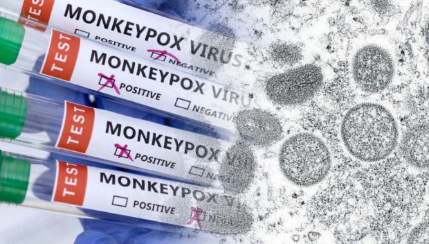 Test tube marked "Monkeypox Virus” STORY: LGBTQ+ group: Set record straight on how monkeypox spreads