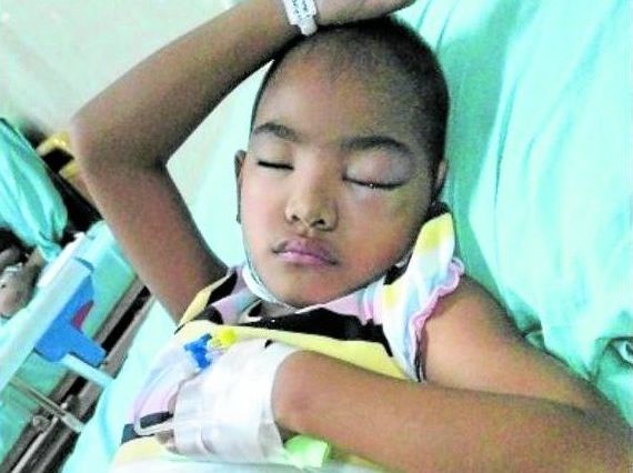 Princess Ihmet Cabana STORY: Girl fights to save remaining eye